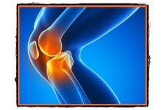 Artroza genunchiului sau gonartroza